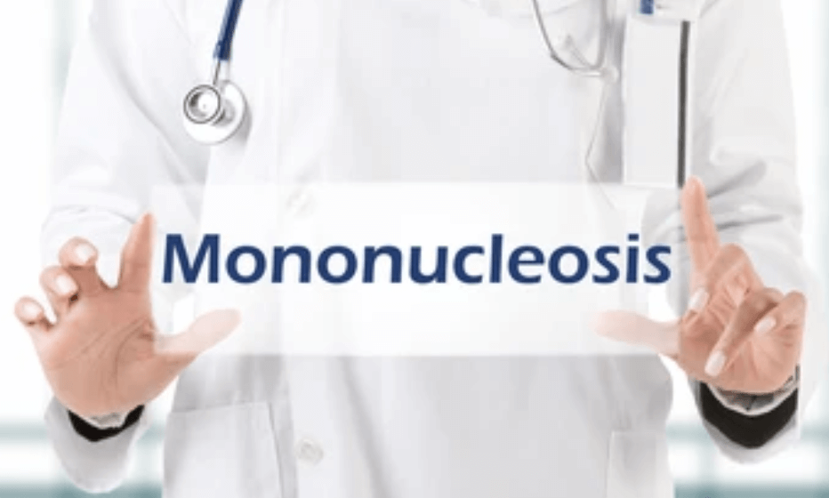 Mononucleosis 