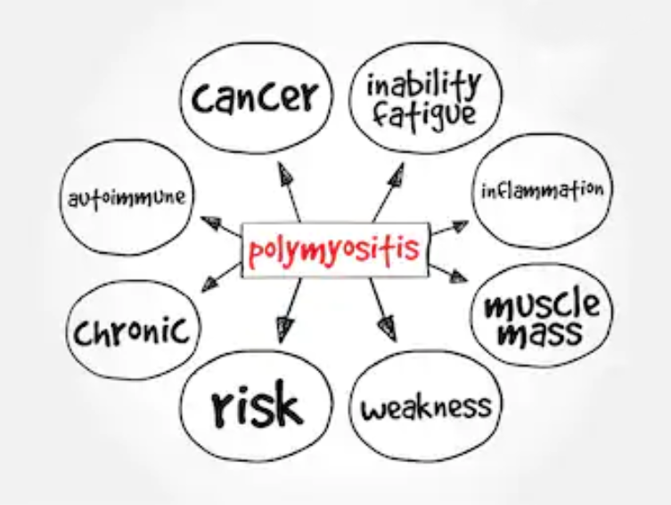 Polymyositis